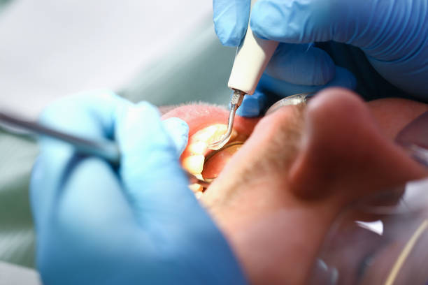 Best Walk-In Emergency Dentist in Chebanse, IL