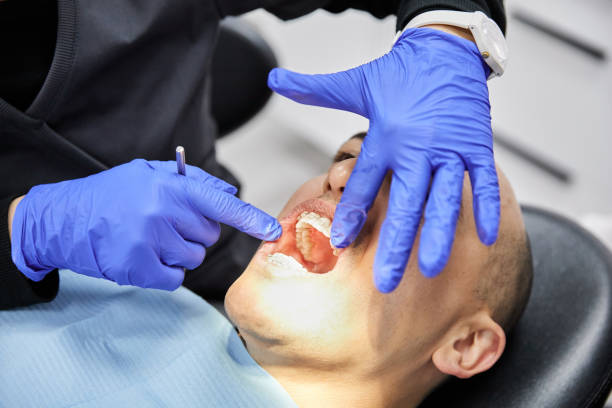 Best Emergency Broken Tooth Repair in Chebanse, IL